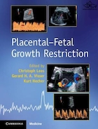 Placental-Fetal Growth Restriction | محدودیت رشد و ثبات جفت